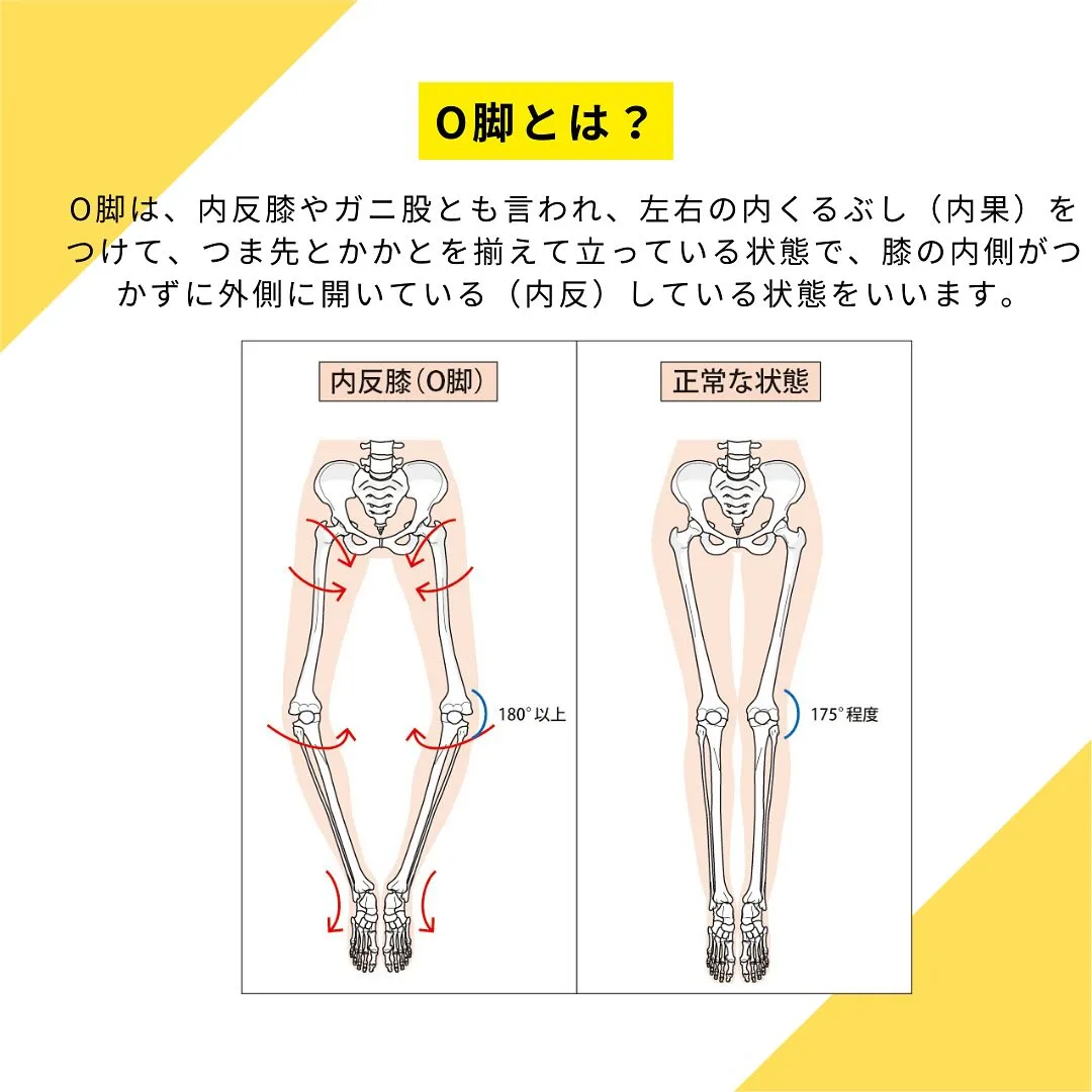 日頃何気なく行なっている『不良姿勢』が原因で