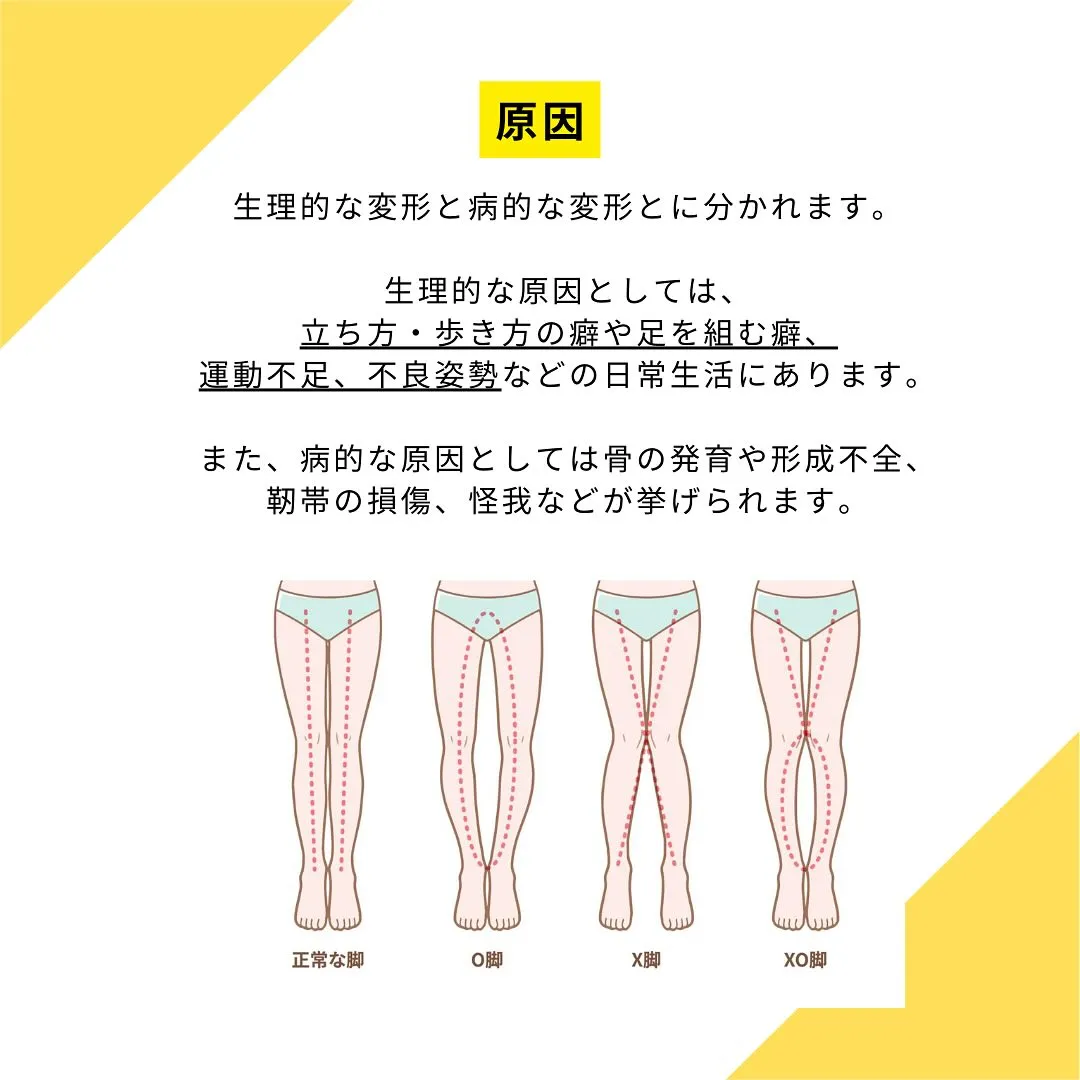 日頃何気なく行なっている『不良姿勢』が原因で