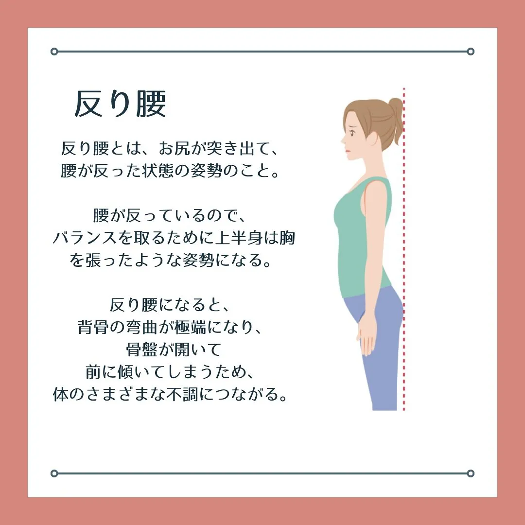 反り腰って意外と多くの人が悩んでいる姿勢の問題ですよね😣。