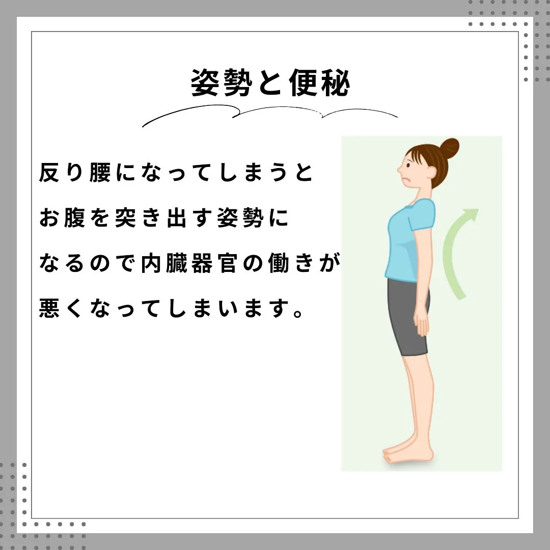 反り腰が便秘のカギ 南区大橋