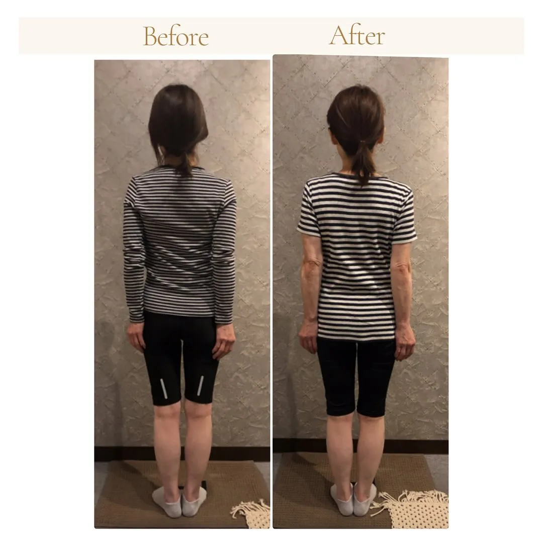 美容整骨で「後ろ姿・背中美人へ」　南区大橋