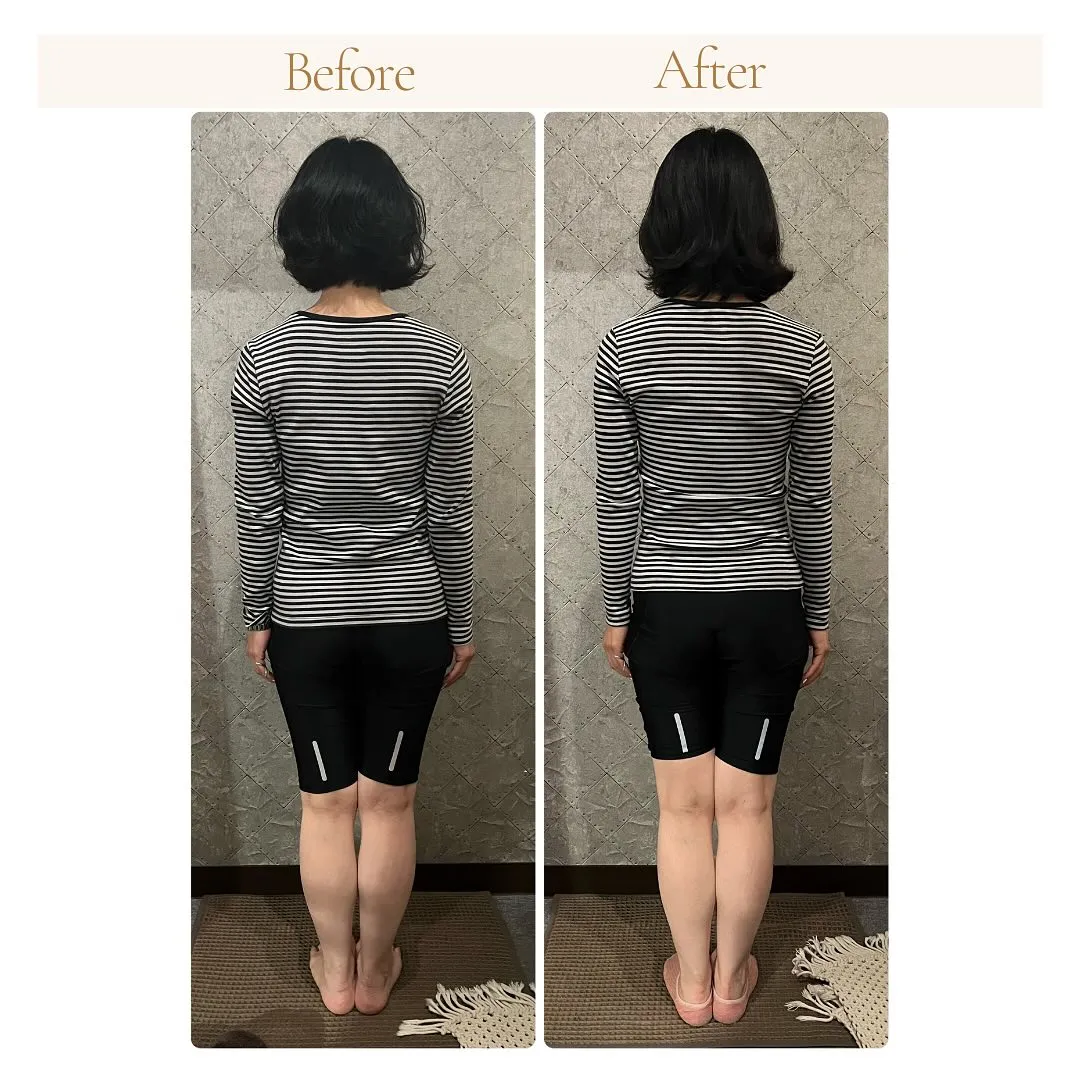 美容整骨で「後ろ姿・背中美人へ」　南区大橋