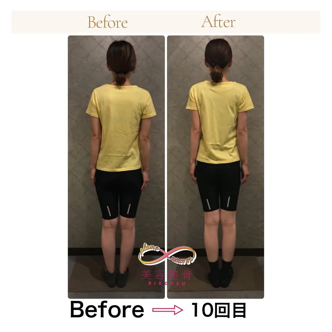 美容整骨で「後ろ姿・背中美人へ」 南区大橋