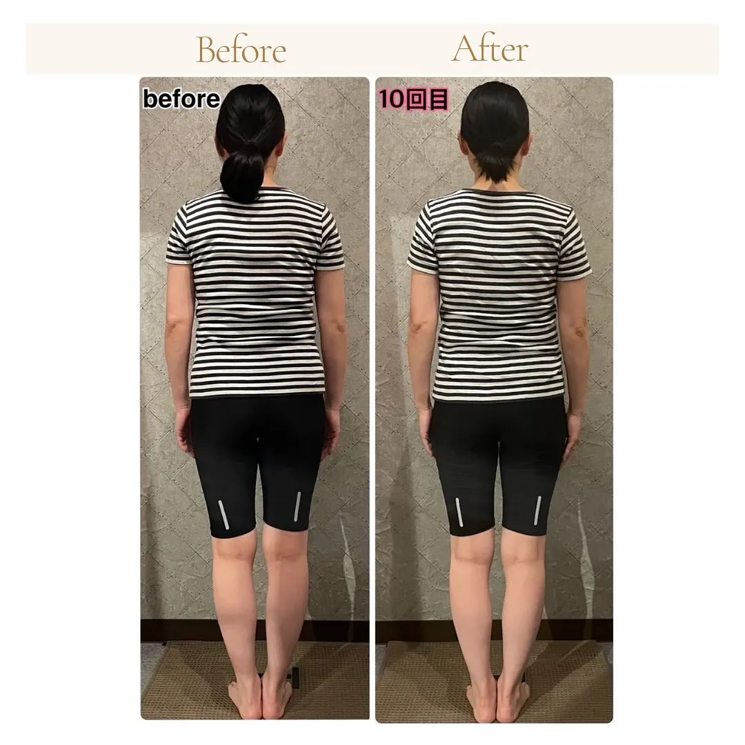 美容整骨で「後ろ姿・背中美人へ」 南区大橋