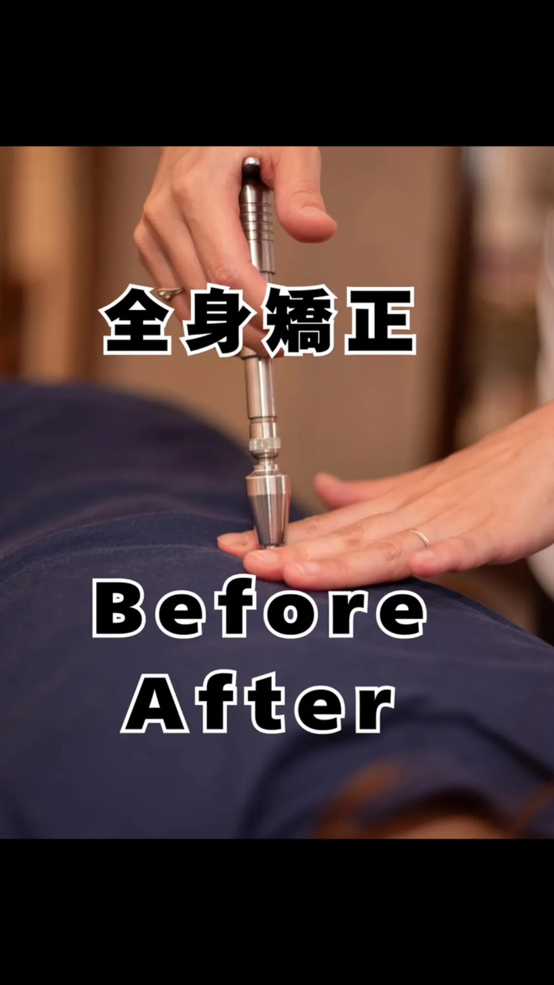 骨の歪み根本アプローチ　福岡市南区