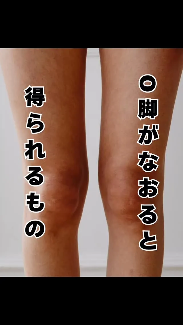 実はO脚が原因かもしれません！　おおはし駅