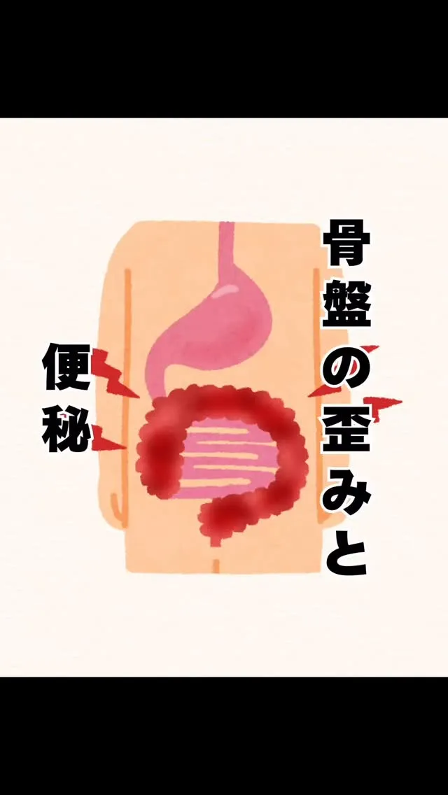 骨盤の歪みからくる便秘　福岡県福岡市